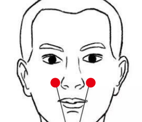 呼吸系统疾病（鼻炎）—取穴参考方案(图3)