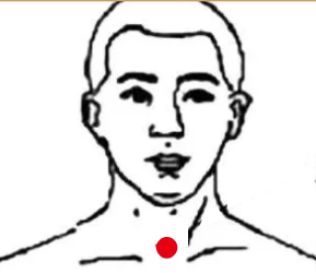 呼吸系统疾病（咳嗽）—取穴参考方案(图3)