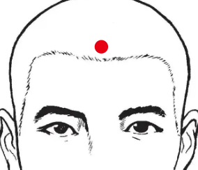 呼吸系统疾病（鼻炎）—取穴参考方案(图2)