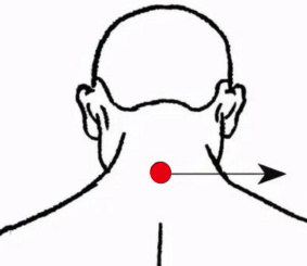 呼吸系统疾病（头晕）—取穴参考方案(图2)