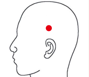 呼吸系统疾病（偏头痛）—取穴参考方案(图2)