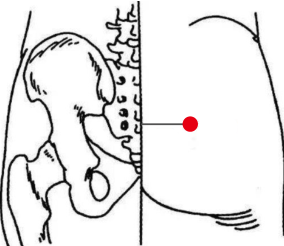 骨关节疾病（梨状肌综合症）—取穴参考方案(图2)