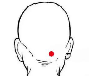 骨关节疾病（颈椎病）—取穴参考方案(图1)