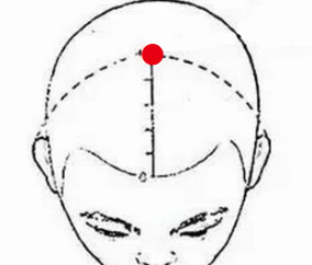 呼吸系统疾病（脑供血不足）—取穴参考方案(图1)