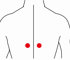 呼吸系统疾病（甲状腺结节）—取穴参考方案(图3)