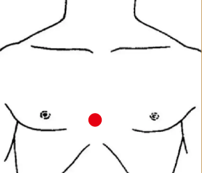 呼吸系统疾病（支气管扩张）—取穴参考方案(图3)