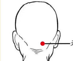 呼吸系统疾病（落枕）—取穴参考方案(图1)