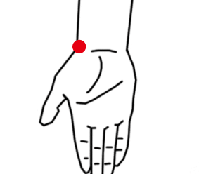 呼吸系统疾病（肺结节）—取穴参考方案(图2)