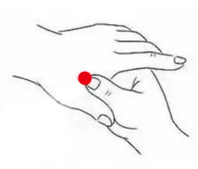 呼吸系统疾病（鼻炎）—取穴参考方案(图1)