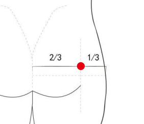 骨关节疾病（坐骨神经痛）—取穴参考方案(图2)