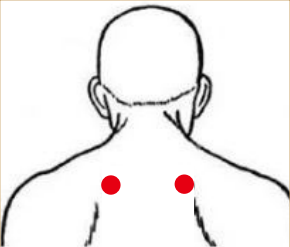 呼吸系统疾病（急性支气管炎）—取穴参考方案(图1)
