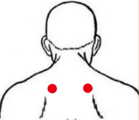 呼吸系统疾病（慢性支气管炎）—取穴参考方案(图1)