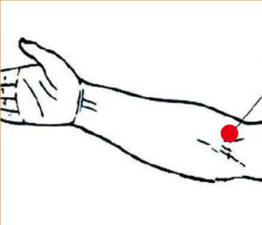 呼吸系统疾病（支气管扩张）—取穴参考方案(图2)