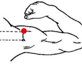 骨关节疾病（肩周炎）—取穴参考方案(图2)