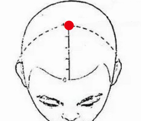 呼吸系统疾病（头晕）—取穴参考方案(图1)