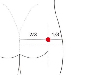 骨关节疾病（急性腰扭伤）—取穴参考方案(图2)