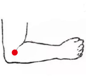骨关节疾病（肩周炎）—取穴参考方案(图3)