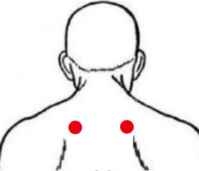 呼吸系统疾病（肺结核）—取穴参考方案(图1)