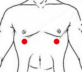 呼吸系统疾病（胸膜炎）—取穴参考方案(图3)