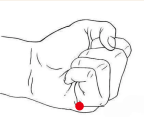 骨关节疾病（腰椎间盘突出）—取穴参考方案(图1)