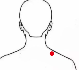 骨关节疾病（肩周炎）—取穴参考方案(图1)