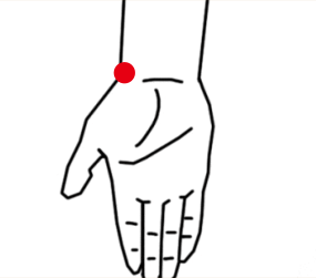 呼吸系统疾病（肺结核）—取穴参考方案(图2)