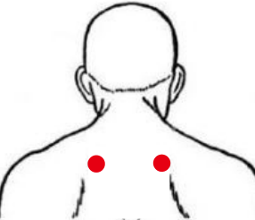 呼吸系统疾病（胸膜炎）—取穴参考方案(图1)