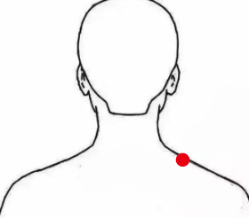 呼吸系统疾病（头痛）—取穴参考方案(图2)