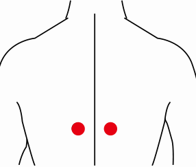 呼吸系统疾病（甲亢）—取穴参考方案(图3)