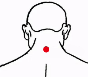 呼吸系统疾病（落枕）—取穴参考方案(图2)