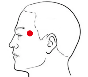 呼吸系统疾病（偏头痛）—取穴参考方案(图3)
