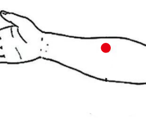 呼吸系统疾病（支气管扩张）—取穴参考方案(图1)