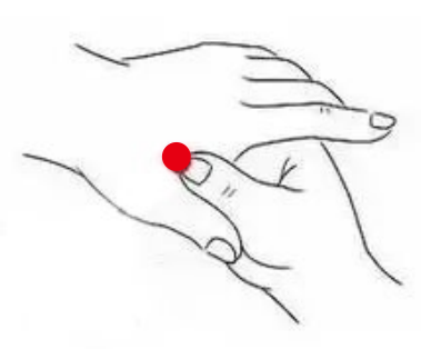 骨关节疾病（口腔溃疡）—取穴参考方案(图1)