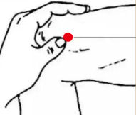 骨关节疾病（风湿性关节炎病）—取穴参考方案(图2)