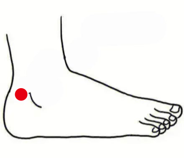 骨关节疾病（足跟痛）—取穴参考方案(图2)