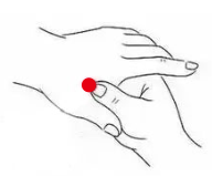 骨关节疾病（痛风性关节炎）—取穴参考方案(图1)