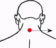 骨关节疾病（急性带状疱疹）—取穴参考方案(图1)