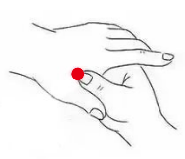 骨关节疾病（牙痛）—取穴参考方案(图1)