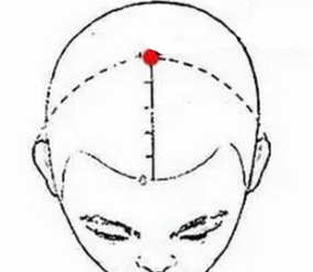 消化系统疾病（胃痉挛）—取穴参考方案(图1)
