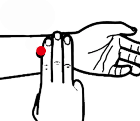 消化系统疾病（胃溃疡）—取穴参考方案(图2)