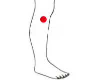 骨关节疾病（退行性骨关节炎）—取穴参考方案(图2)