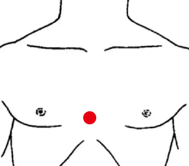 骨关节疾病（反酸）—取穴参考方案(图1)