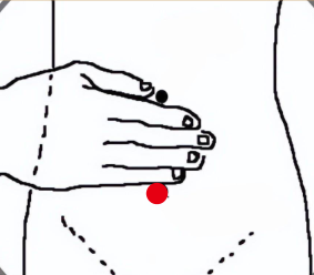 消化系统疾病（胃息肉）—取穴参考方案(图2)