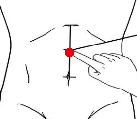 消化系统疾病（腹痛）—取穴参考方案(图3)