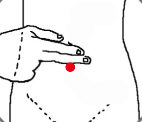 消化系统疾病（肠息肉）—取穴参考方案(图2)