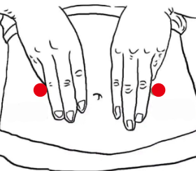 消化系统疾病（肠息肉）—取穴参考方案(图1)