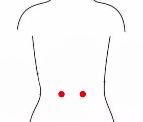 妇科疾病（子宫肌瘤）—取穴参考方案(图2)