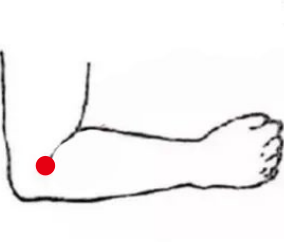 心脑血管疾病（中风后遗症上肢瘫）—取穴参考方案(图2)