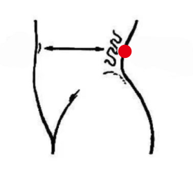 心脑血管疾病（慢性肾炎）—取穴参考方案(图2)