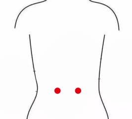 心脑血管疾病（慢性肾炎）—取穴参考方案(图1)